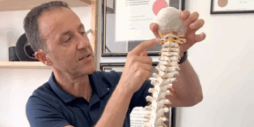 Cervicogenic Headaches