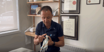 Plantar Fascia
